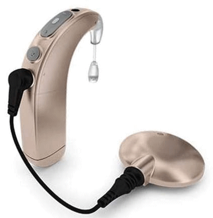 Cochlea Implantat